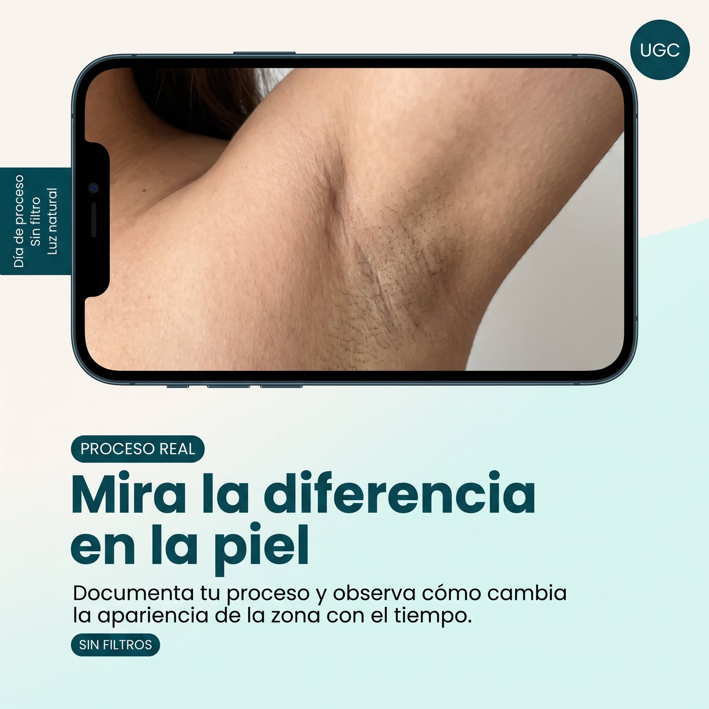 Luretti™ Sérum de ácido mandélico nivel 2
