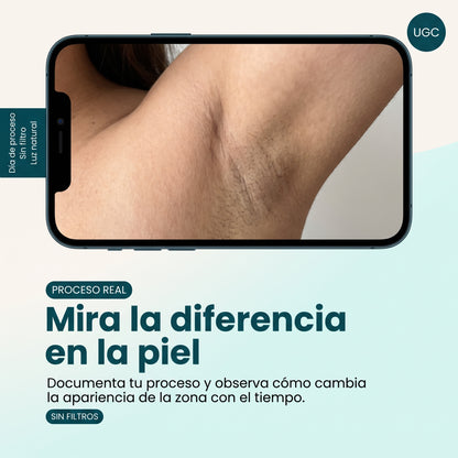 Luretti™ Sérum de ácido mandélico nivel 2