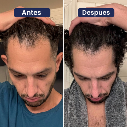 Reverso. Serum para el crecimiento del cabello