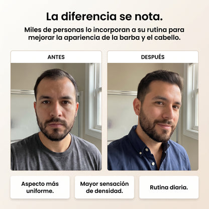 Spectral Men's | Sérum para la densidad capilar con Nanoxidil al 5%
